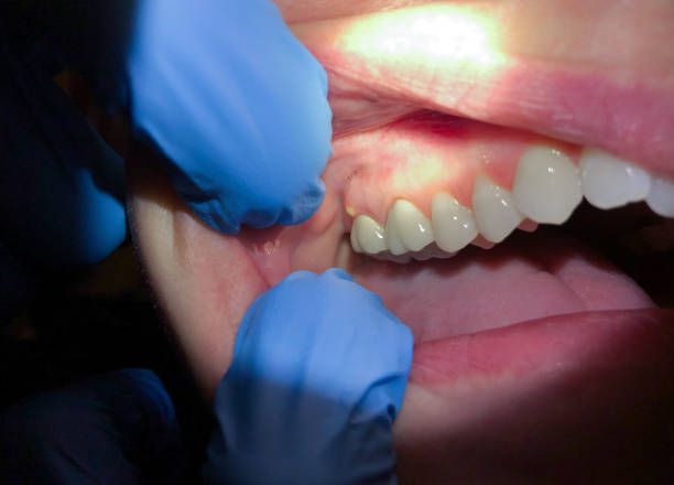 Best Emergency Orthodontic Repairs in Daleville, VA